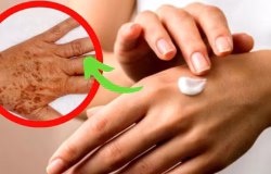 Manchas e envelhecimento nas mãos: soluções acessíveis para uma pele mais suave e uniforme