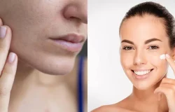 Mistura caseira de creme Nivea e óleo natural combate a pele seca com economia e praticidade