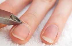 O fim do alicate: Especialistas explicam como cuidar das cutículas para unhas mais saudáveis