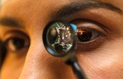 ocular1