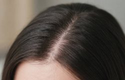 Por que a coceira no couro cabeludo persiste mesmo após trocar de shampoo