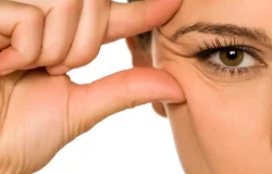 Quatro procedimentos dermatológicos ajudam a suavizar rugas ao redor dos olhos
