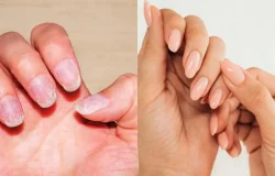 Sete cuidados simples para recuperar unhas fracas e quebradiças